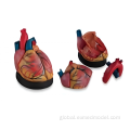 China Enlarged Heart Anatomy Model Supplier